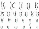 Syndrome Karyotype Analyses sketch template