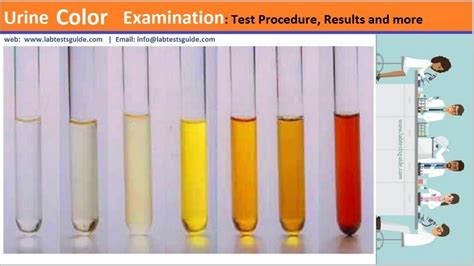 urine color test examination    lab tests guide