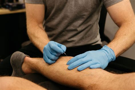 dry needling  rochester hills michigan limitless physical therapy performance