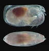 Image result for "conchoecia Magna". Size: 96 x 100. Source: www.marinespecies.org