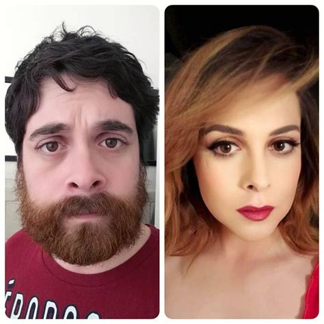 Male To Female Hormone Therapy Before And After Pictures