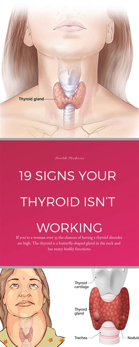 19 signs your thyroid isn t working thyroid disorders thyroid