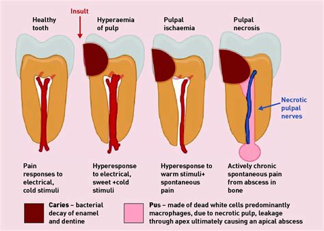 understanding  managing dental  orofacial pain  general practice british journal