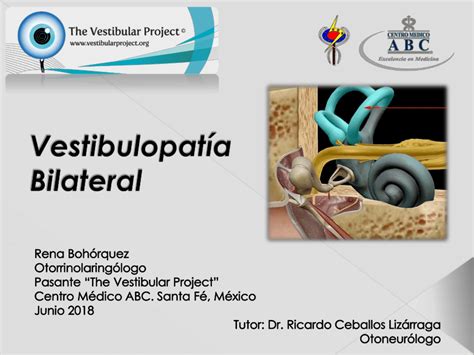 vestibulopatia bilateral bilateral vestibular loss