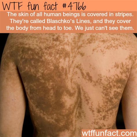 humans  stripes   skin wtf fun wtf fun facts fun