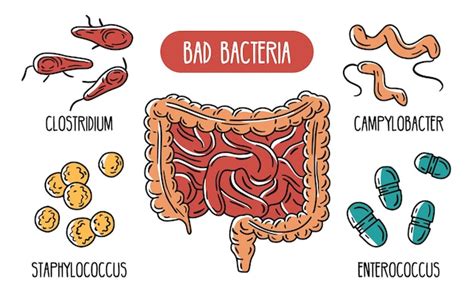 Infografía De Vector De Las Bacterias Intestinales Humanas Malas