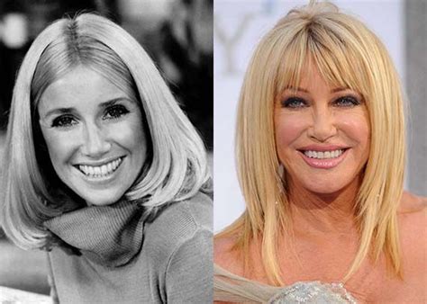 suzanne somers plastic surgery before and after photos oops celebrity plastic surgery