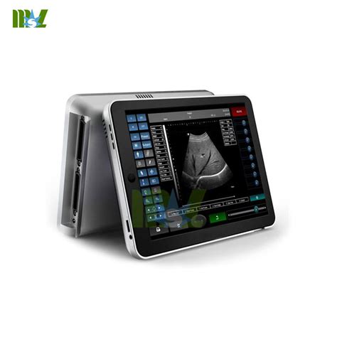 Cost Effective Clinic Ipad Ultrasound Scanner Mslpu09