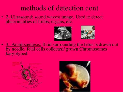 Ppt Genetic Disorders And Testing Powerpoint Presentation Free