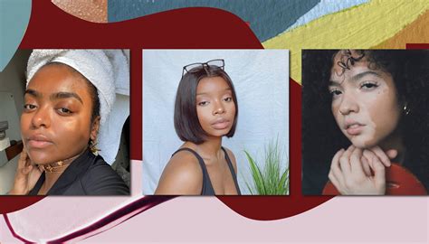 Black Women With Skin Conditions Share Their Paths To Diagnosis Allure