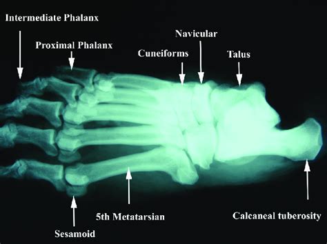 radiological lateral view   specimen  scientific diagram