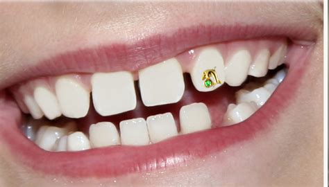 teeth jewelry diamond teeth dental research