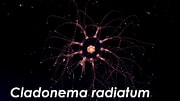 Afbeeldingsresultaten voor "cladonema Radiatum". Grootte: 180 x 101. Bron: www.youtube.com