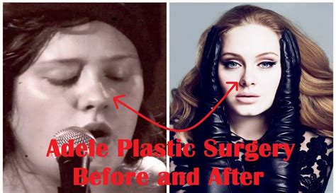 Adele Nose Job Before And After Nice Plastic Ass And