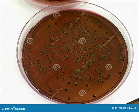 lactobacillusspp   medium stock photo image  science coli
