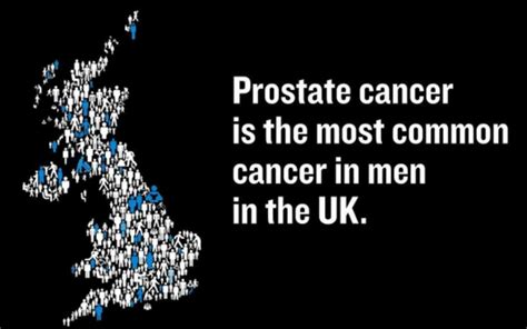 Prostate Cancer Becomes A Bigger Killer Than Breast Cancer A