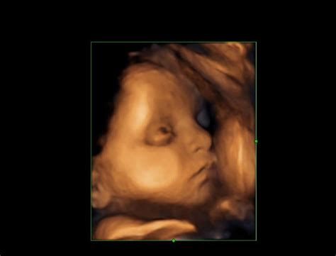 getting a 3d 4d ultrasound when you re pregnant~ the best experience one big happy photo