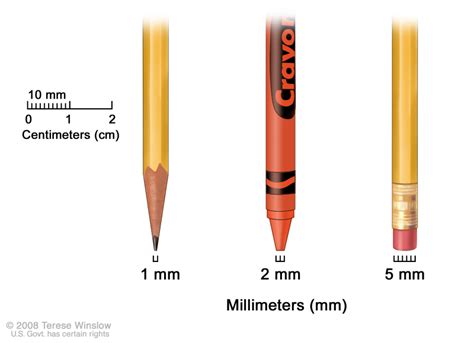 figure millimeters mm  sharp pencil pdq cancer information
