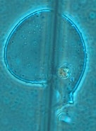 Afbeeldingsresultaten voor "Protocystis Harstoni". Grootte: 136 x 185. Bron: plankton.mio.osupytheas.fr
