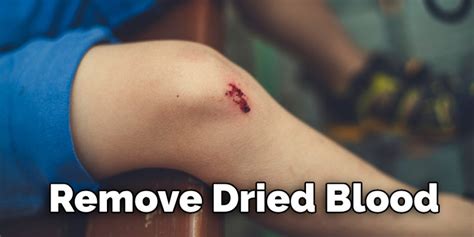 dried blood   skin detailed guide