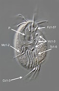 Afbeeldingsresultaten voor "diophrys Appendiculata". Grootte: 121 x 185. Bron: www.mikroskopie-forum.de