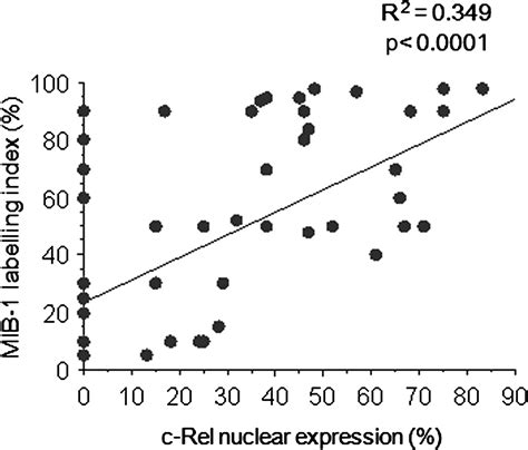 clinicopathologic significances of nuclear expression of nuclear factor κb transcription factors