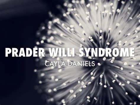 Prader Willi Syndrome By Ezrahjones