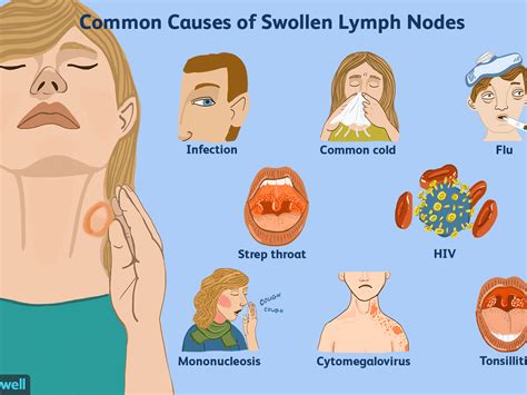 Who Else Wants Info About How To Reduce Swelling Of Lymph Nodes