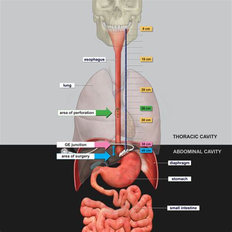 Anatomy Of Esophagus And Stomach Trialexhibits Inc