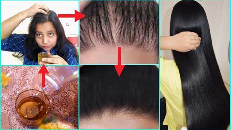 Apply This Best Hair Fall Solution On Your Hair And Stop Hair Fall