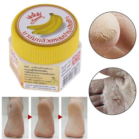 Hand Foot Crack Cream Heel Chapped Peeling Anti Dry Banana Repair Foot