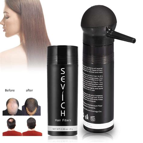 Cheap Hair Loss Products Black Women Find Hair Loss Products Black