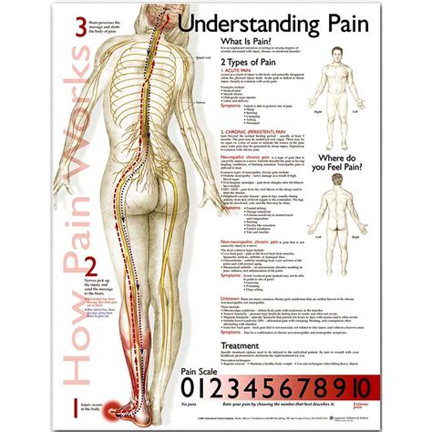 understanding pain anatomical chart
