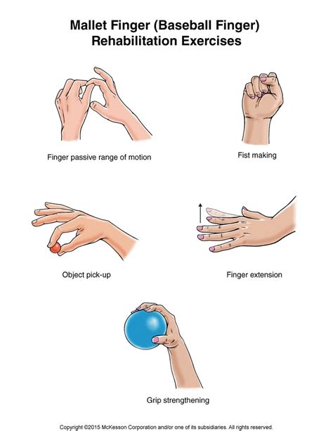 mallet finger baseball finger exercises tufts medical center
