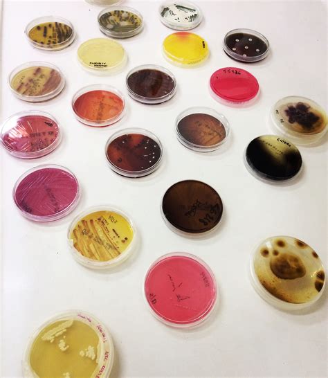 petri plates petriplates microbiology bacteria yeast lab microbiologylab