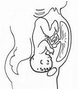 Drawing Womb Baby Placenta Anterior Spinning Babies Getdrawings sketch template