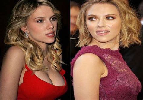 scarlett johansson before and after breast implants celebrity before and after celebrity
