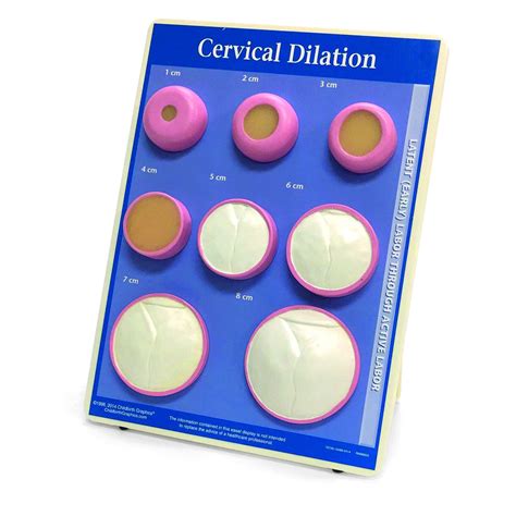 cervical effacement dilation model childbirth graphics