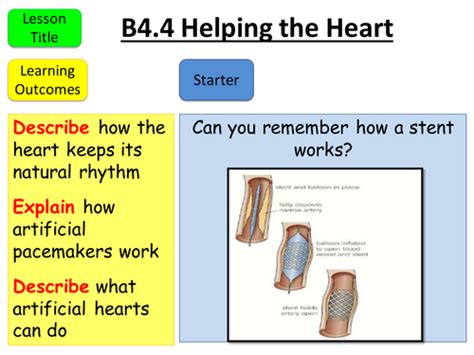 Aqa Gcse B4 4 Helping The Heart Teaching Resources
