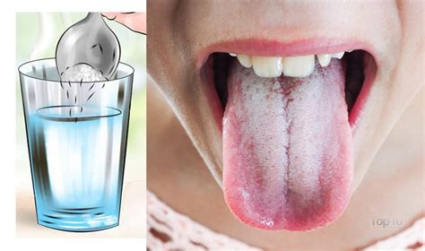 home remedies for a white coated tongue top 10 home remedies