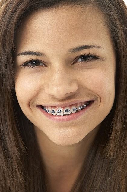the hunt orthodontics blog dr hunt and our team think