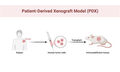 simplified overview  patient derived xenograft model pdxpatient derived xenograft model pdx