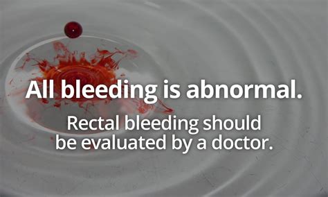rectal bleeding causes and treatment dr havranek