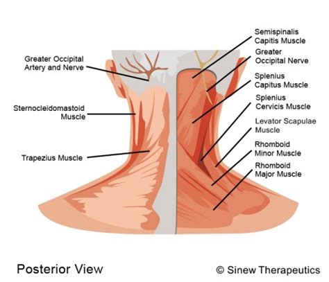 neck strain sprain information sinew therapeutics