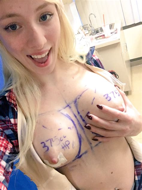 Pornstars With Fake Tits Before And After Breast