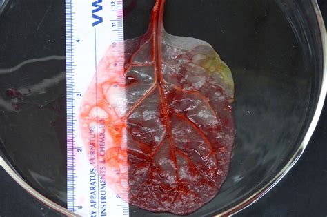 scientists have grown heart tissue on a spinach leaf