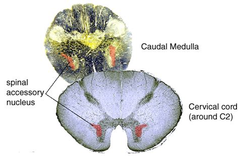 neuroanatomy online lab 10 cranial nerve nuclei and brain stem