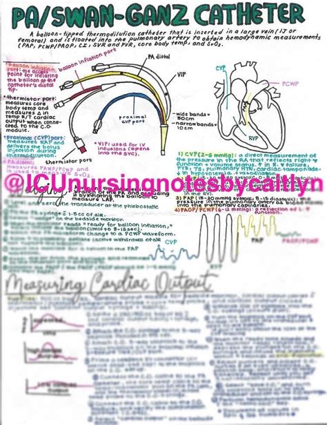 anatomy   swan ganzpulmonary artery catheter pac thermodilution