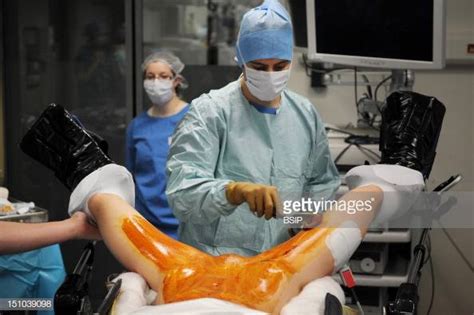 hystero ovariectomy pictures getty images