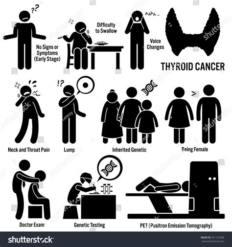 thyroid cancer symptoms causes risk factors stock vector